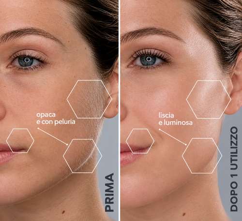 Dermaplaner Sonico Viso 2 in 1